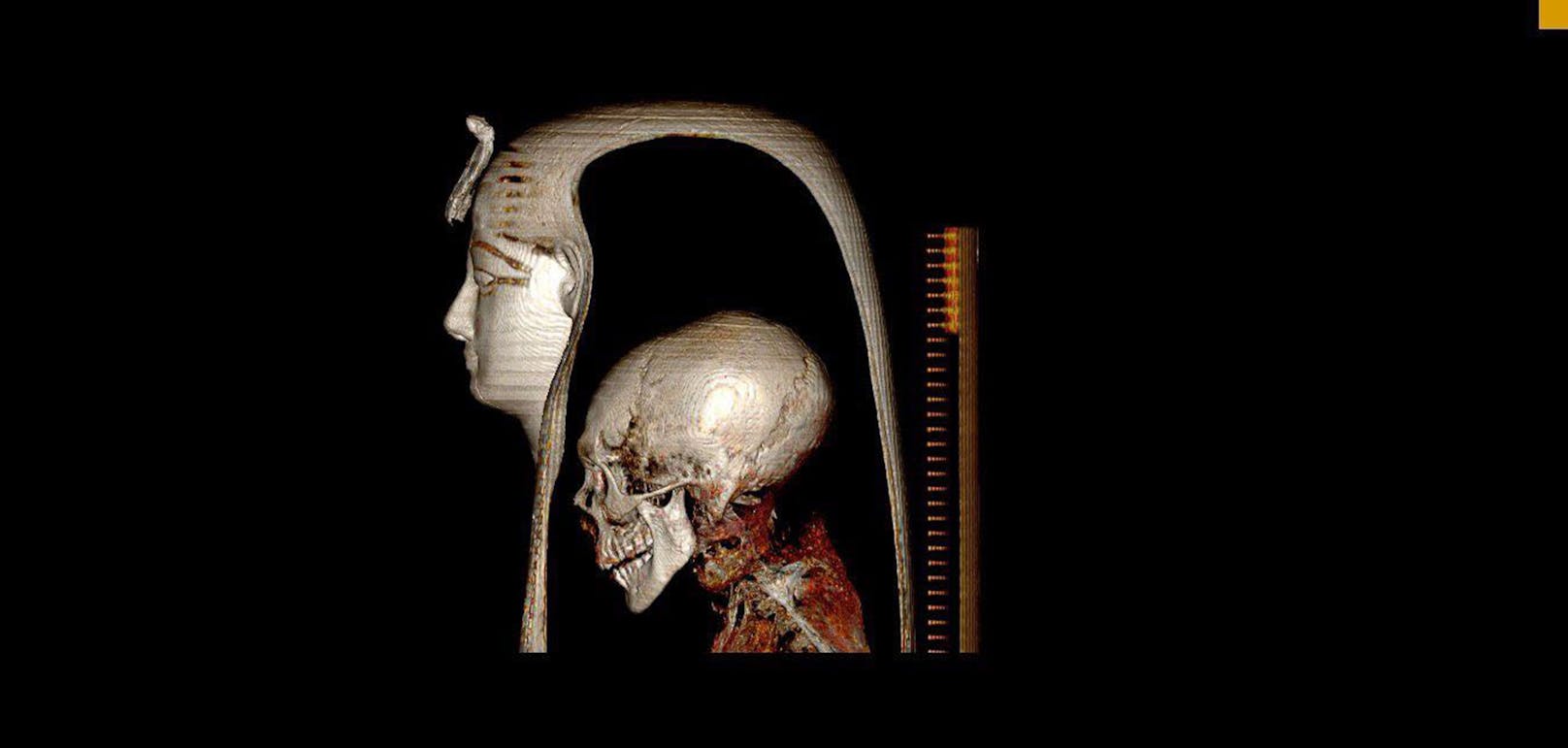 Die dreidimensionale CT-Aufnahme des Kopfes der gewickelten Mumie von Amenhotep I in linkslateraler Ansicht ermöglicht die Visualisierung der Komponentenschichten: der Maske, des Kopfes der Mumie und der umgebenden Verbände.