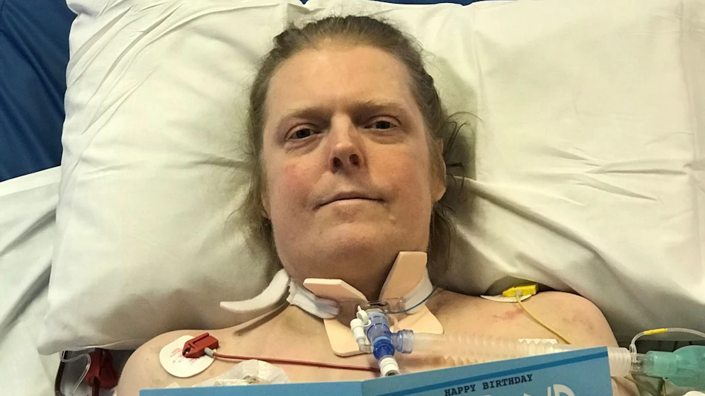 Jason Kelk zählt zu den Covid-19-Patienten in Großbritanniens, die am längsten unter den Folgen einer Corona-Infektion leiden.