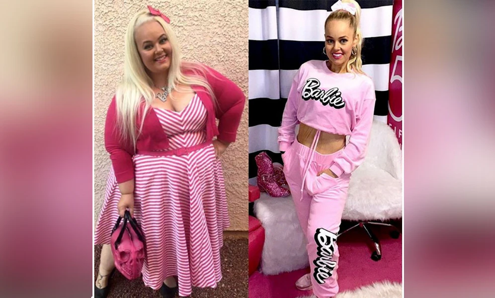 Zwei Jahre und eine Magenverkleinerung später sieht die Australierin Kayla Lavende ihrem Idol immer ähnlicher. 