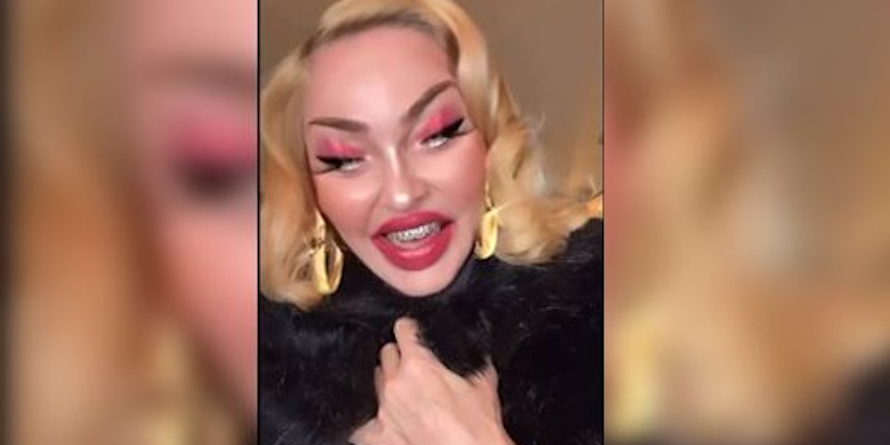 Beauty Op Madonna Schockt Mit Neuem Video Stars Heute At