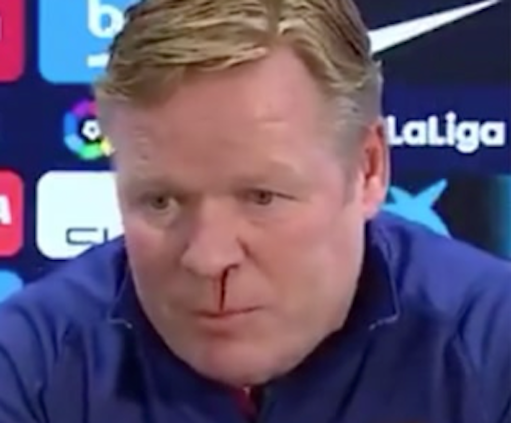 Barca-Trainer Ronald Koeman blutete aus der Nase.