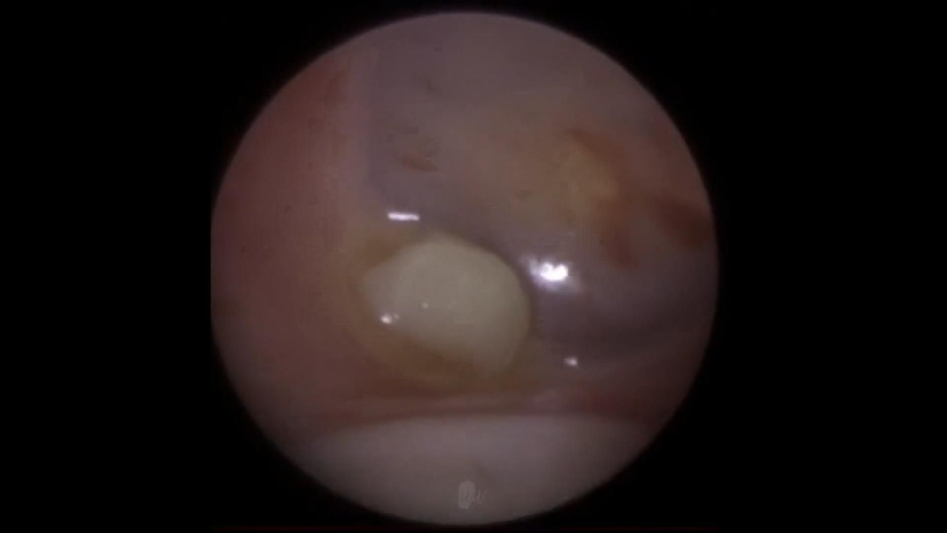 Mr Neel Raithatha aka The Wax Whisperer Mr Neel Raithatha aka The Wax Whisperer