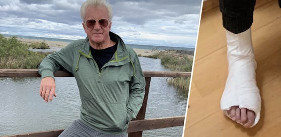Hans P. (73) muss nun Gips tragen.