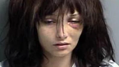 19 Mal erlitt Madison McManus eine Überdosis. Diese schlimmen Zeiten liegen jetzt aber hinter ihr.