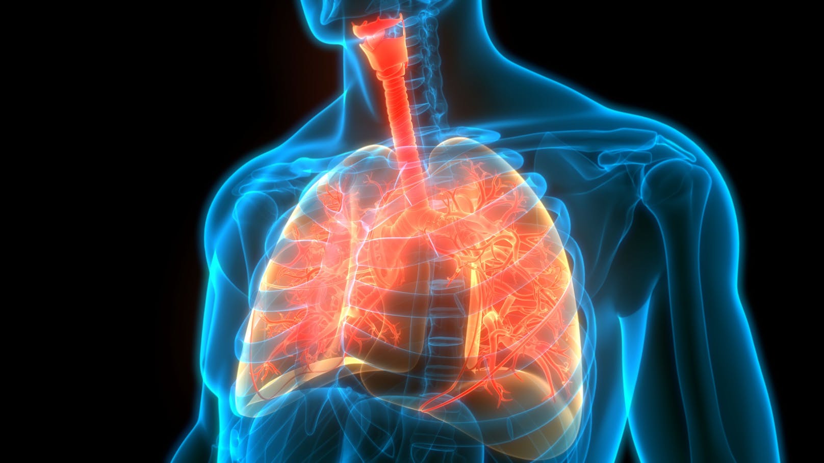 Eingeschränkte Lungenfunktion Auffällige CT-Befunde, beispielsweise Lungenfibrose: 39 - 83 Prozent