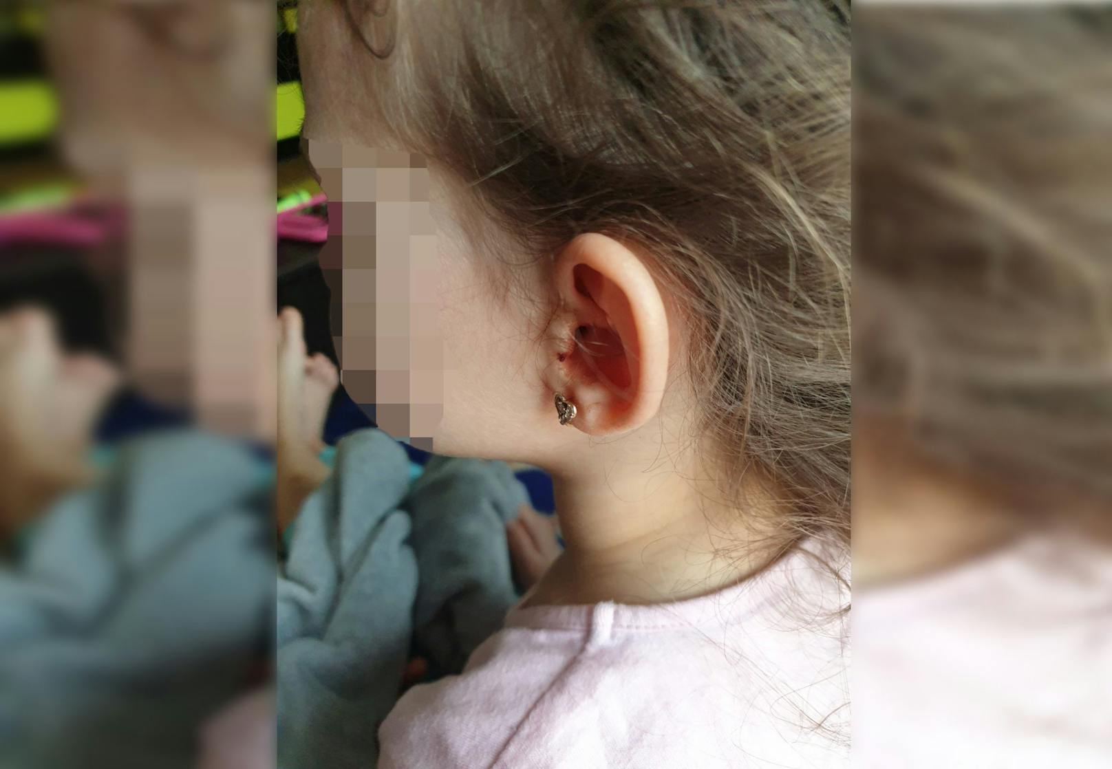 Die 4-jährige Diana blutete aus dem Ohr.