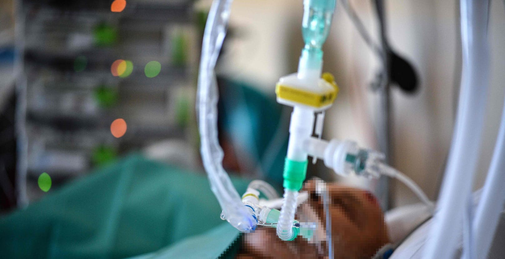 Ein Patient auf einer Corona-Intensivstation. Symbolbild