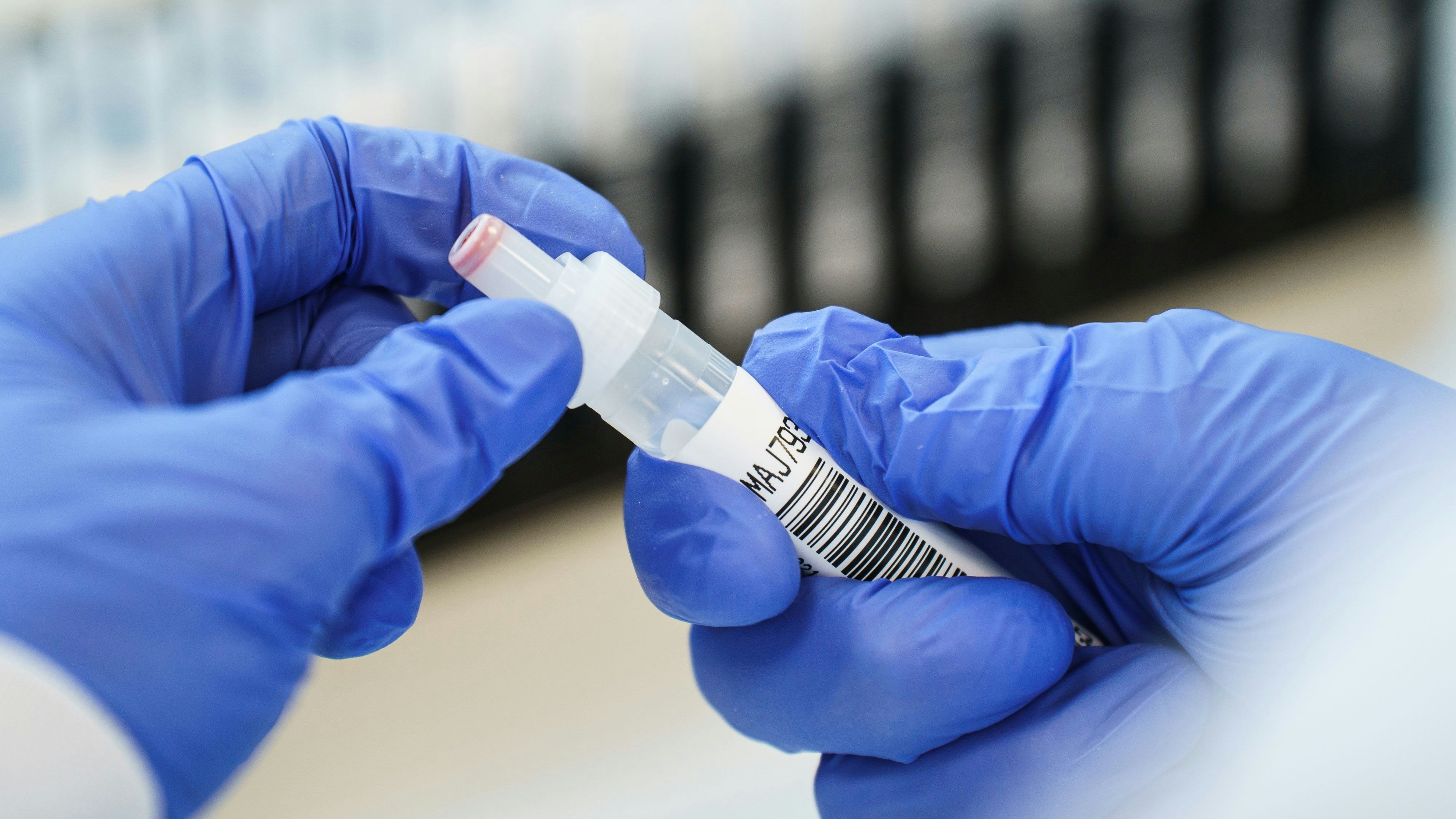 Probe des Coronavirus in einem Labor. Symbolbild