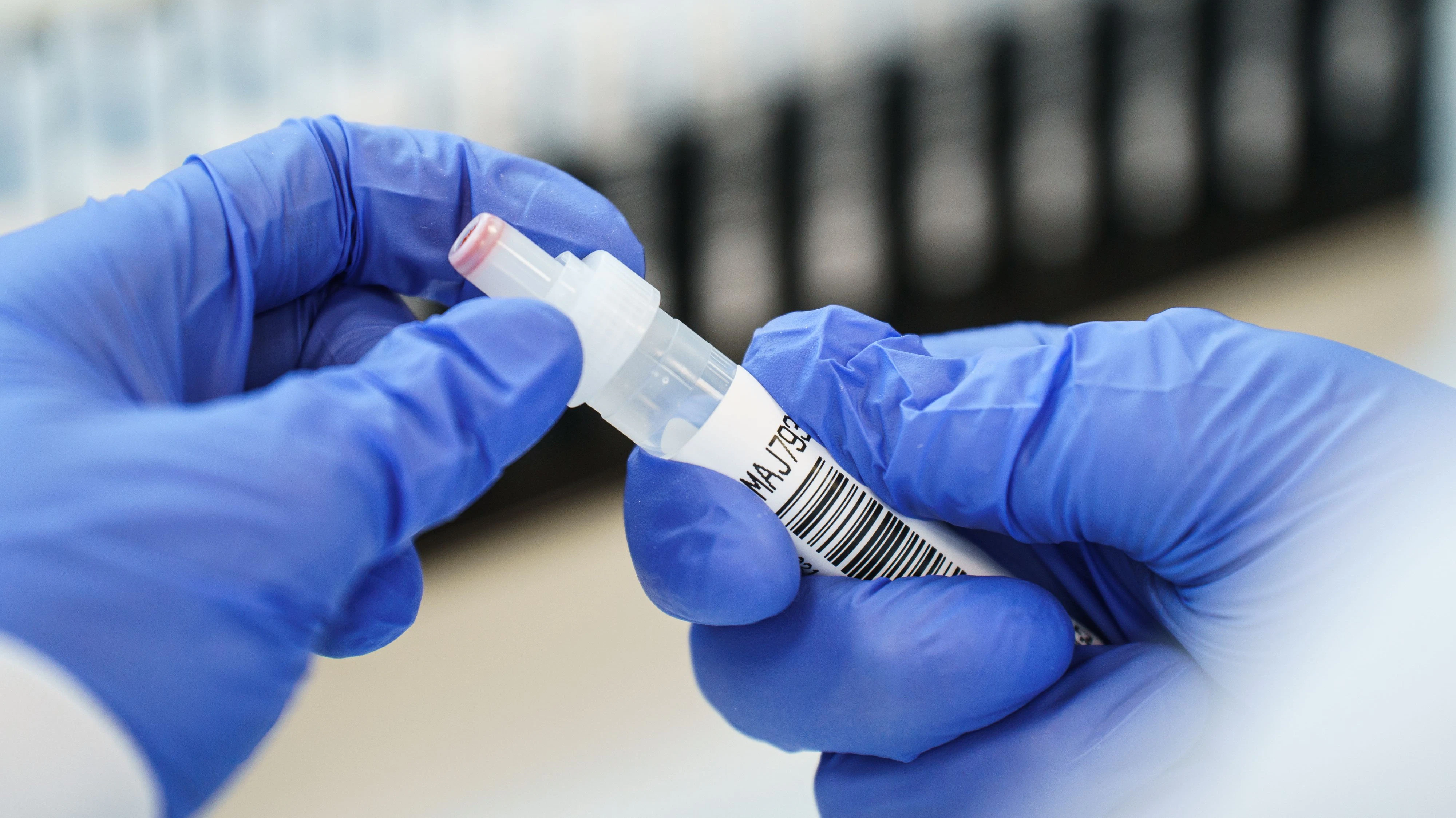 Probe des Coronavirus in einem Labor. Symbolbild