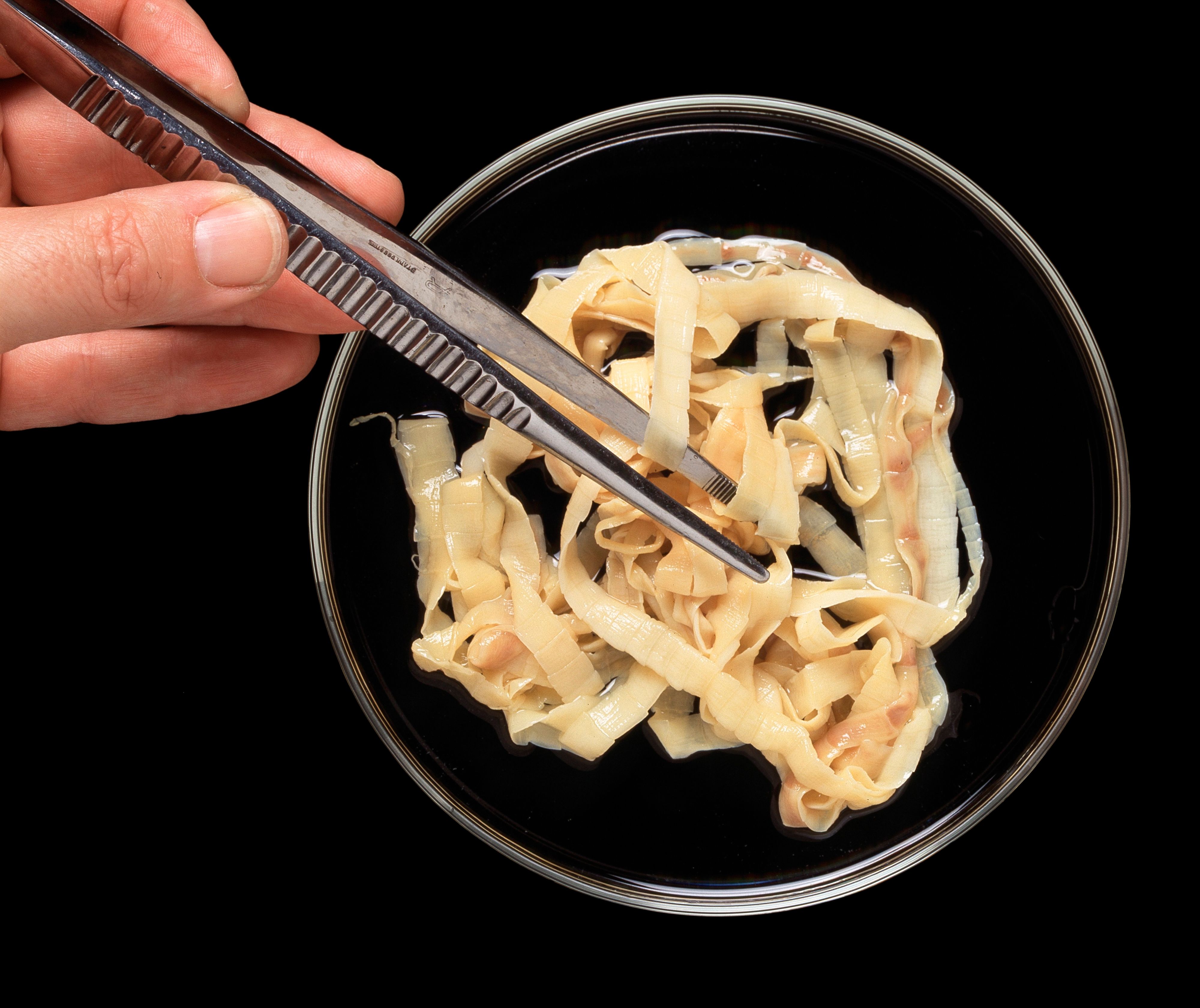 Ein Rinderbandwurm (Taenia saginata). Symbolfoto