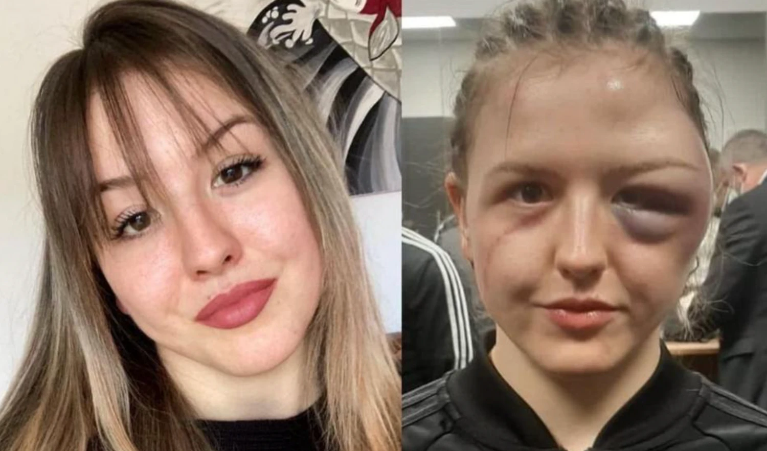 Boxerin Cheyenne Hanson vor und nach dem Kampf.