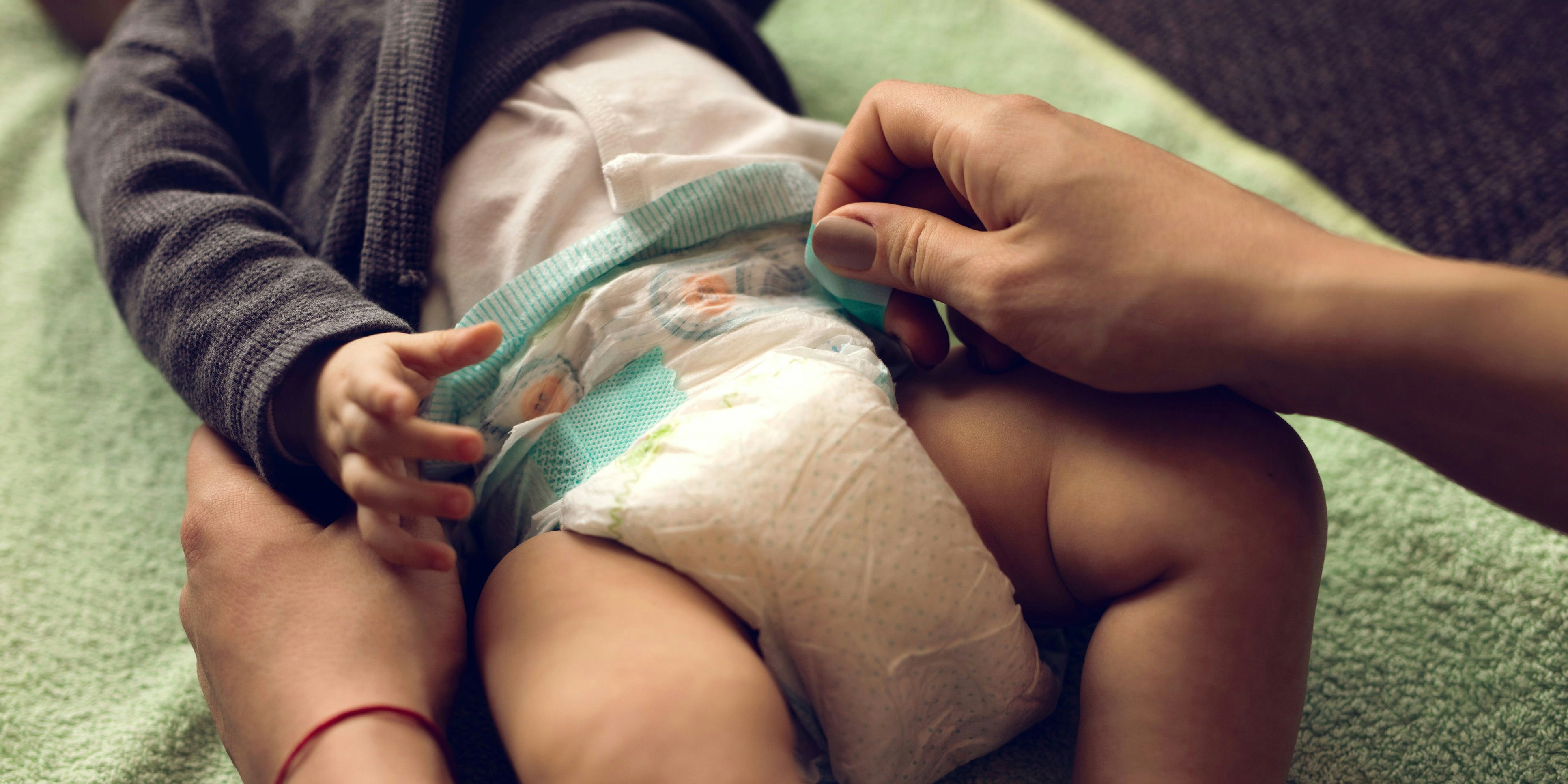 Nahaufnahme eines Babys beim Windel wechseln. Symbolbild