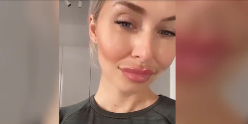 "Ich habe eine erstaunliche Creme über Nacht benutzt": <strong>Lena Gercke</strong> präsentiert ihren Followern ein gewöhnungsbedürftiges Beauty-Ergebnis.<br>