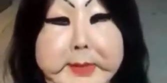 Schönheits-OP misslungen: Trans-Frau fleht um Geld