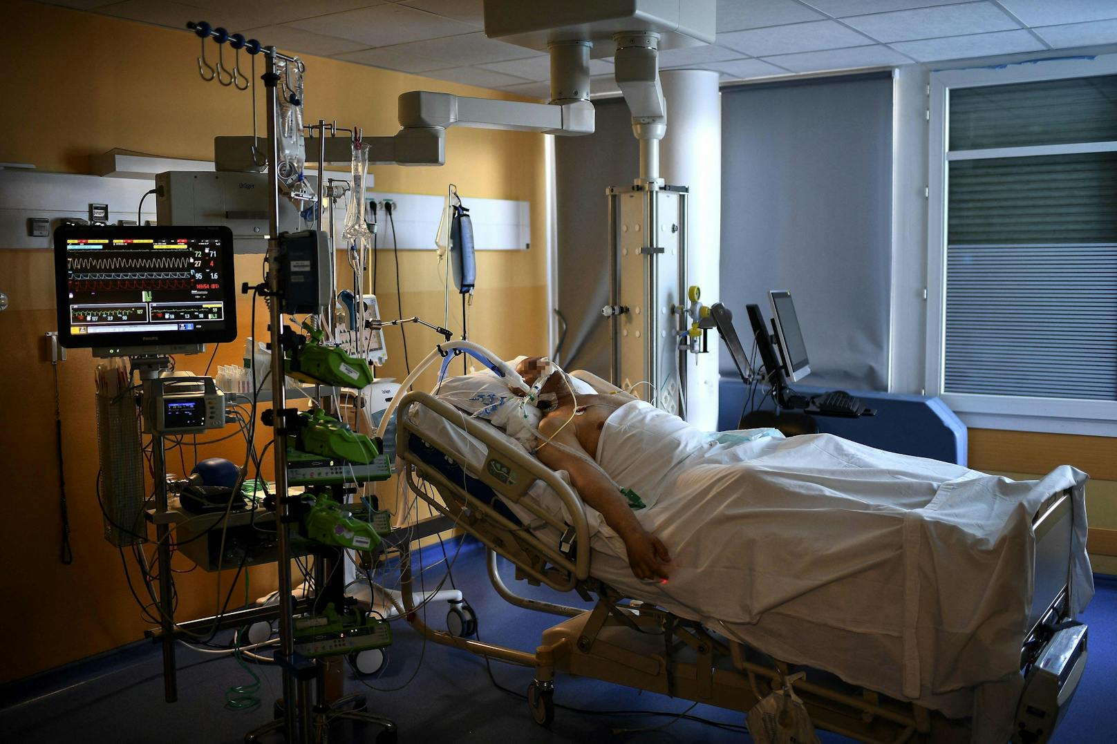 Ein Corona-Patient wird auf einer Intensivstation behandelt.