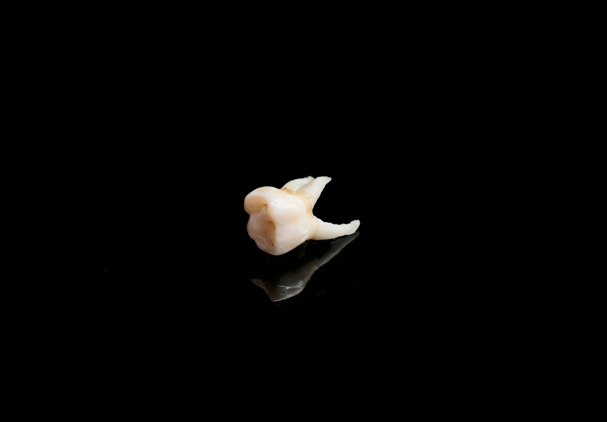 bad tooth remote on a black isolated background