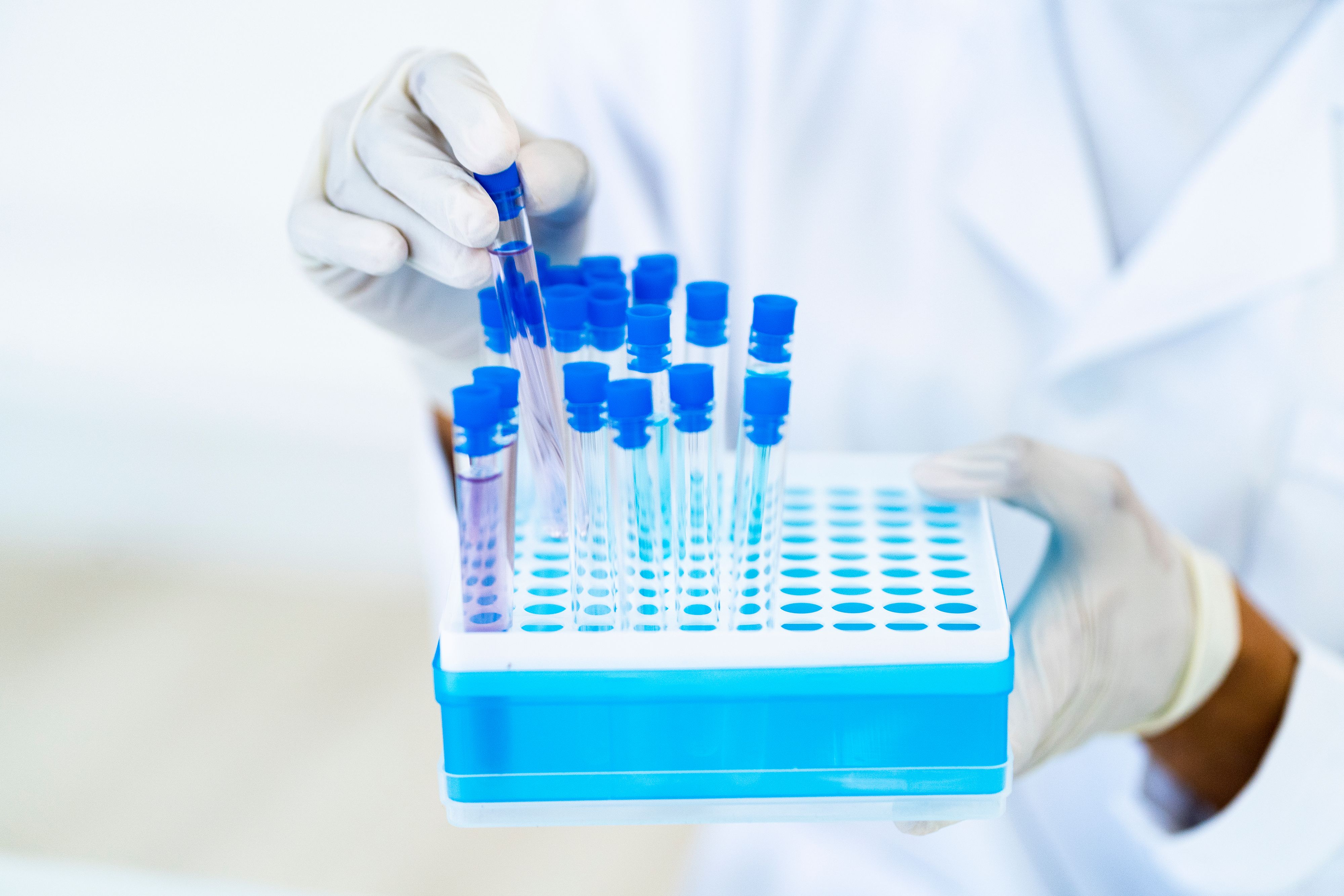 Download von www.picturedesk.com am 19.05.2021 (06:04).  Female researcher with test tubes in microplate at laboratory - 20210320_PD17375 - Rechteinfo: Royalty Free (RF) Model Released