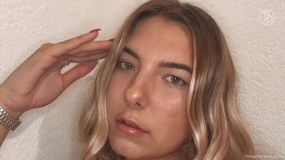 Joelina Karabas hat sich die Lippen aufspritzen lassen.