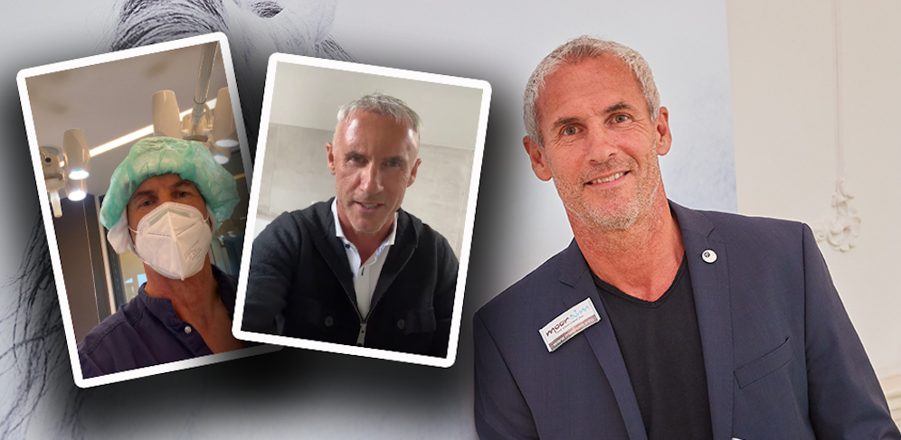 Fußball-Ikone Michael Konsel bekämpft das schüttere Haar. 