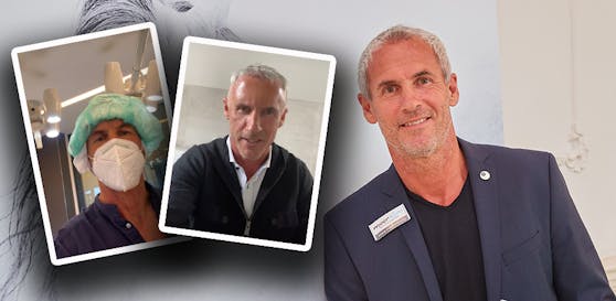 Fußball-Ikone Michael Konsel bekämpft das schüttere Haar.