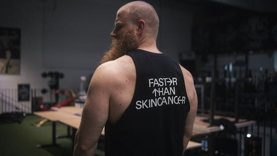 Der Kraftdreikämpfer Alexander Pürzel beteiligt sich an der Aufklärungskampagne "Faster than Skincancer"