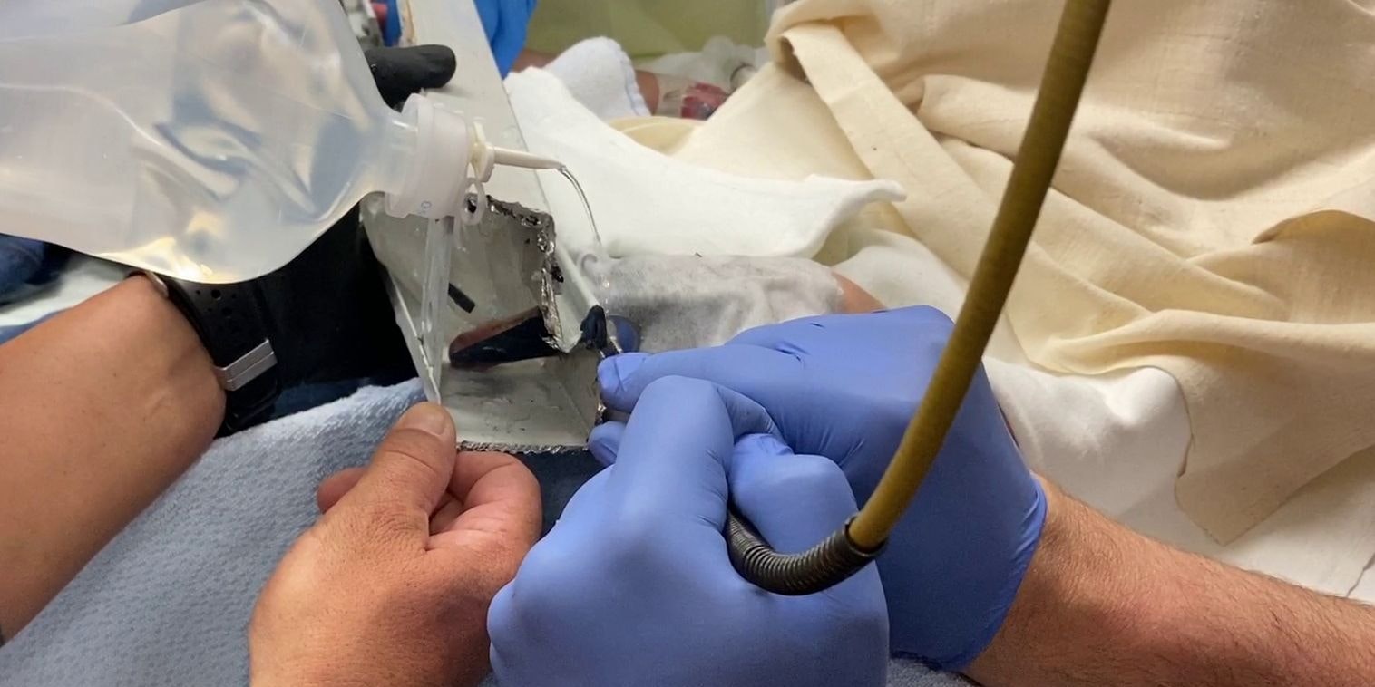 Im Spital kam dann Spezialwerkzeug zum Einsatz.