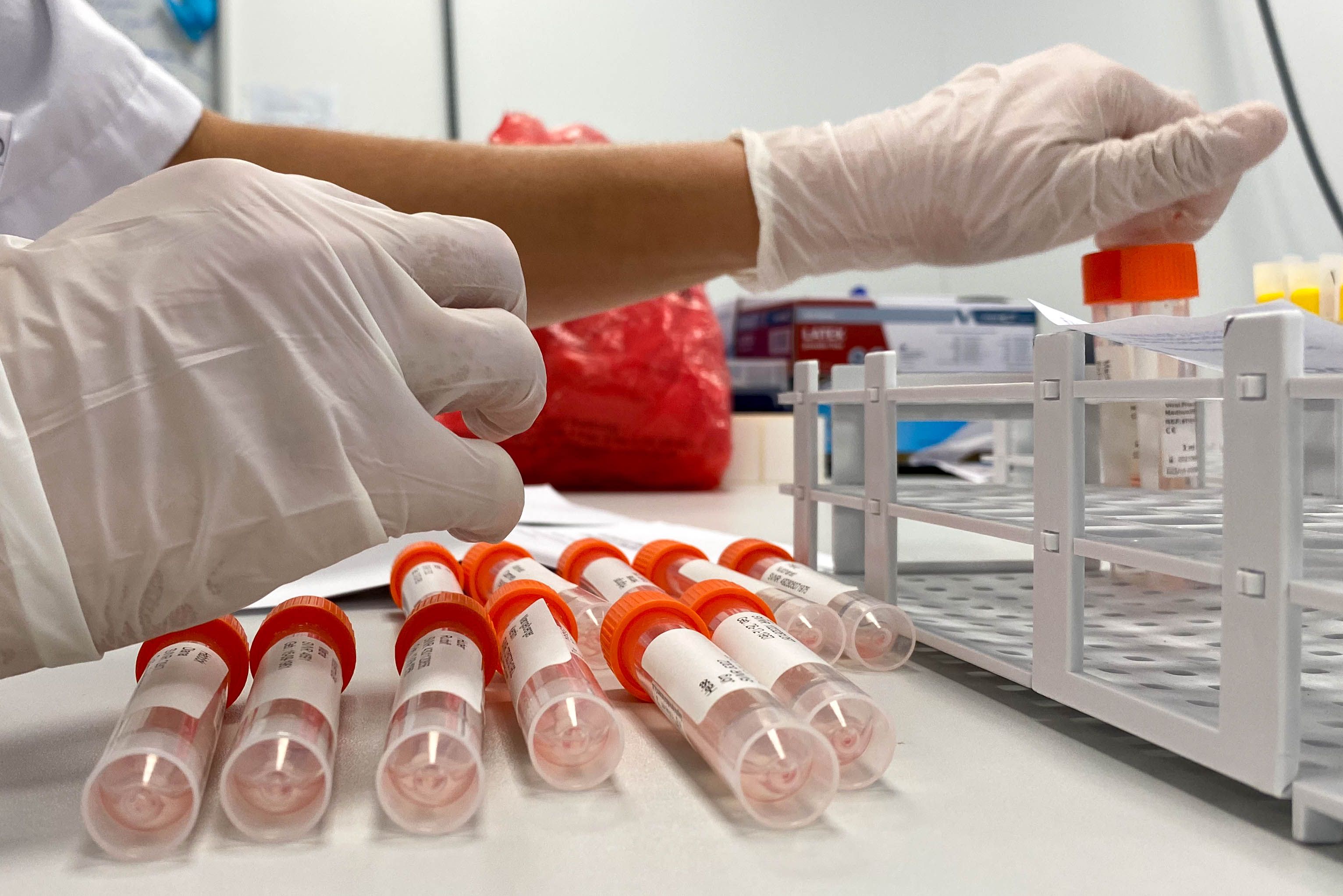 Corona-Test in einem Salzburger Labor (Symbolbild)