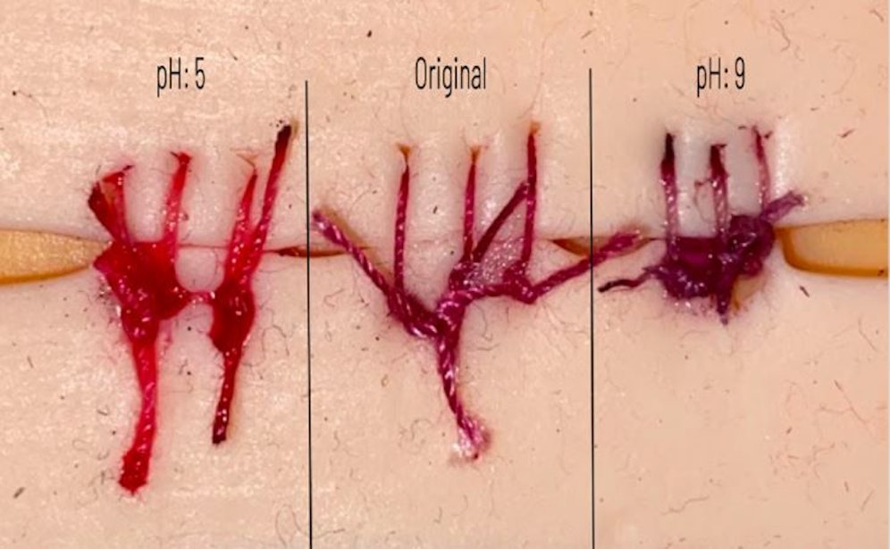 Nach fünf Minuten unter einem infektionsähnlichen pH-Wert ändert sich die Farbe der Wundnähte aus Roten Rüben von leuchtend rot auf dunkelviolett.