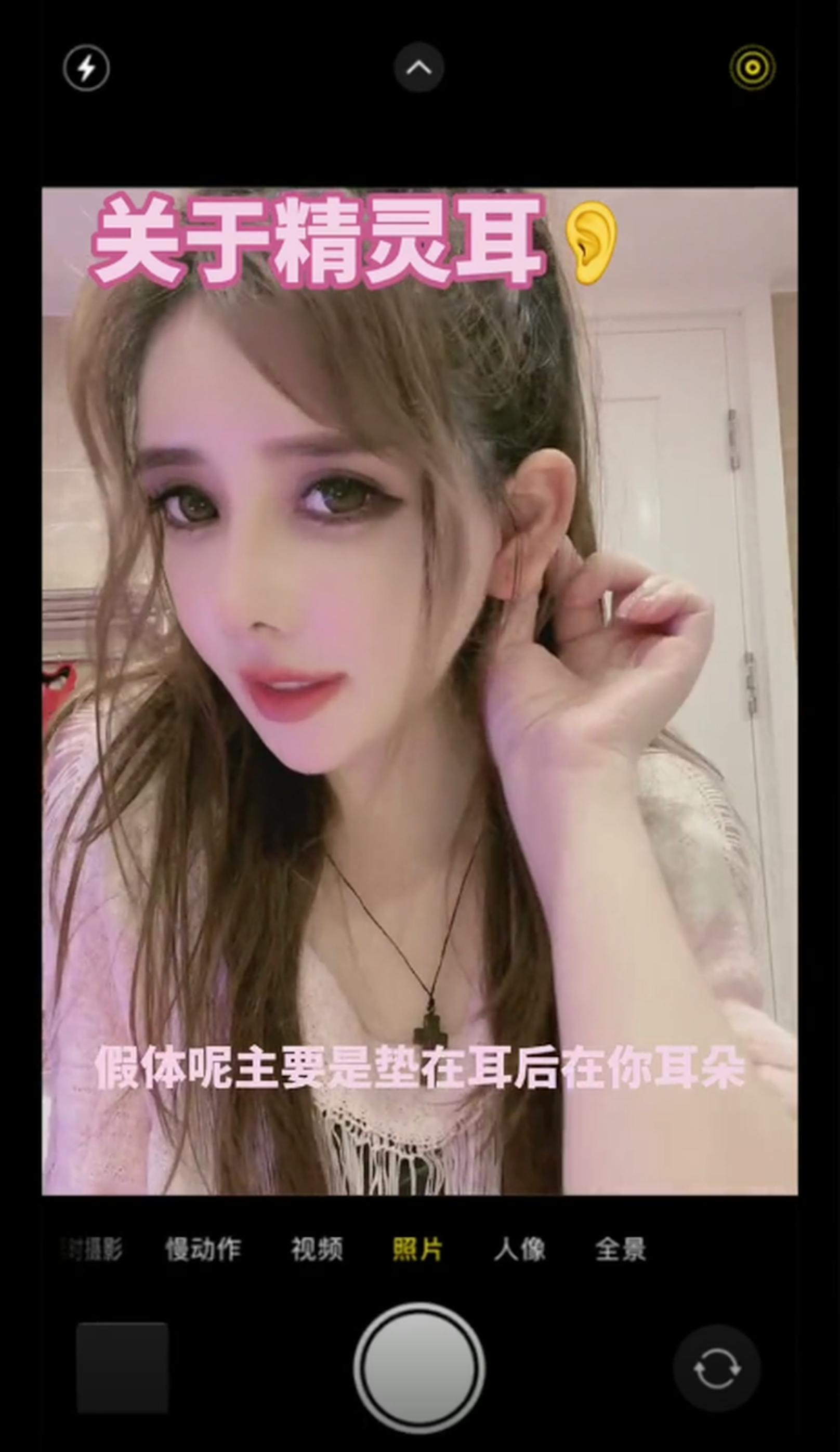 Auf dem chinesischen Social Media Portal Douyin (dem Pendant zu <a data-li-document-ref="100147952" href="https://www.heute.at/s/dieser-tiktok-trend-soll-kilos-purzeln-lassen-100147952">TikTok</a>) spricht Yi Xiao Ge über ihre Erfahrungen mit dem Elf Ear Eingriff. Sie trägt ein Implantat, das die Ohren von hinten nach außen drückt.