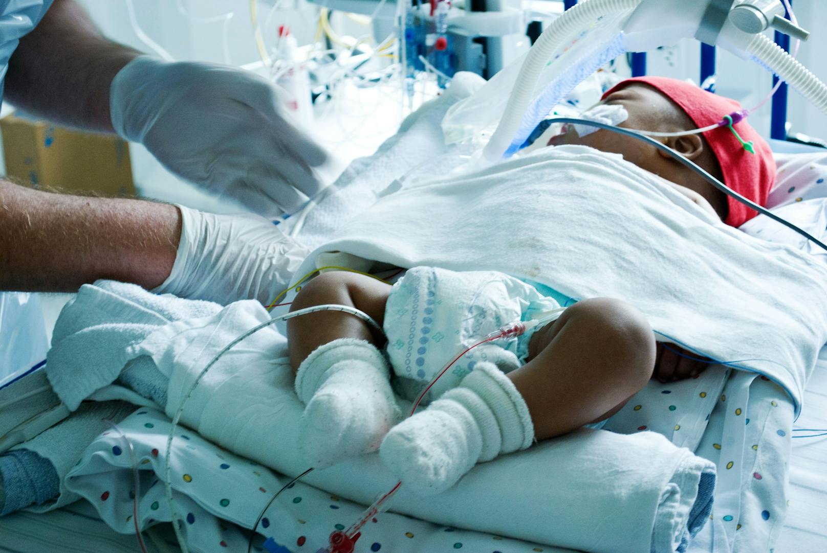 Baby liegt ein Monat nach der Geburt schon wieder im Krankenhaus - mit Verletzungen im AKH (Symbolfoto)
