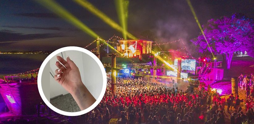 Handverletzung des Opfers, das mit Vergiftung ins Spital kam.