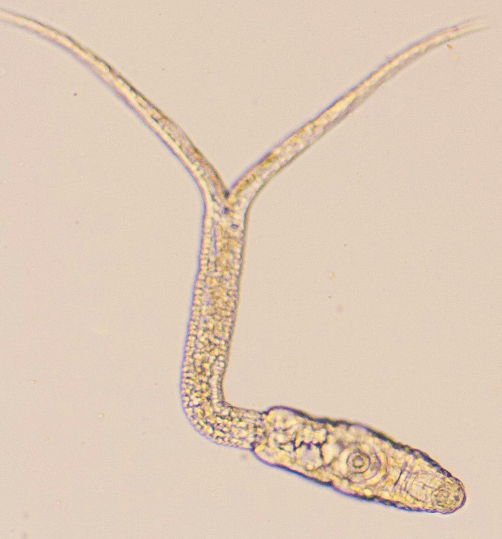 So sieht eine Zerkarie unter dem Mikroskop aus. Eine dieser Art findet man im Linzer Pleschinger See.