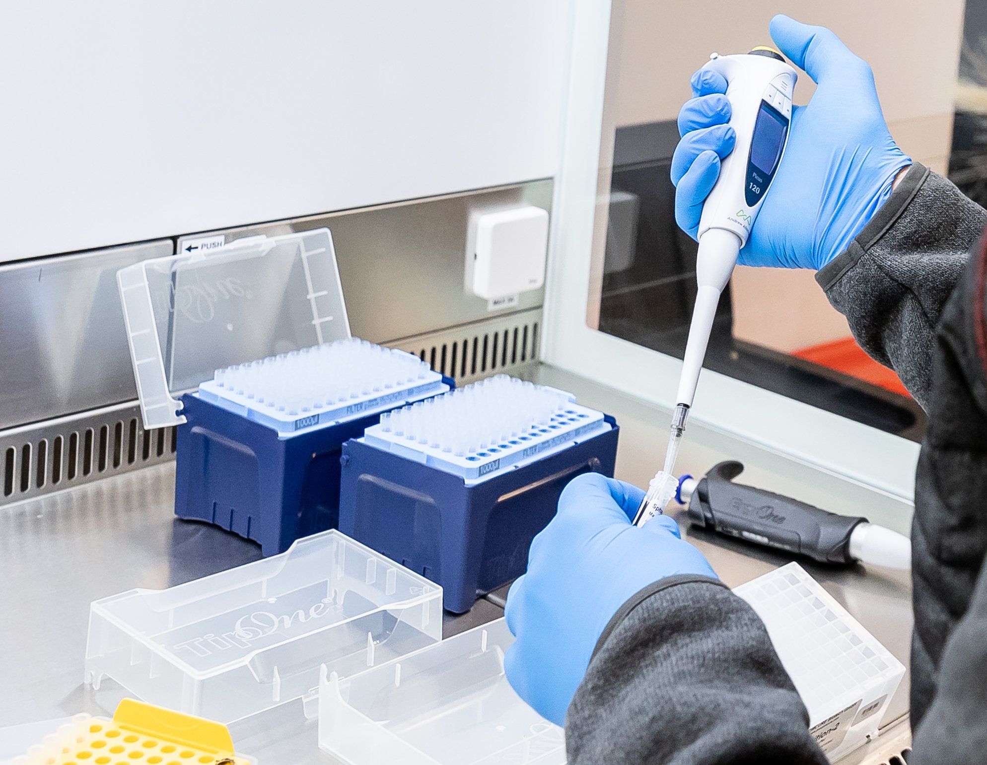 82 Prozent der sequenzierten Corona-Fälle zeigen eine Delta-Mutation.