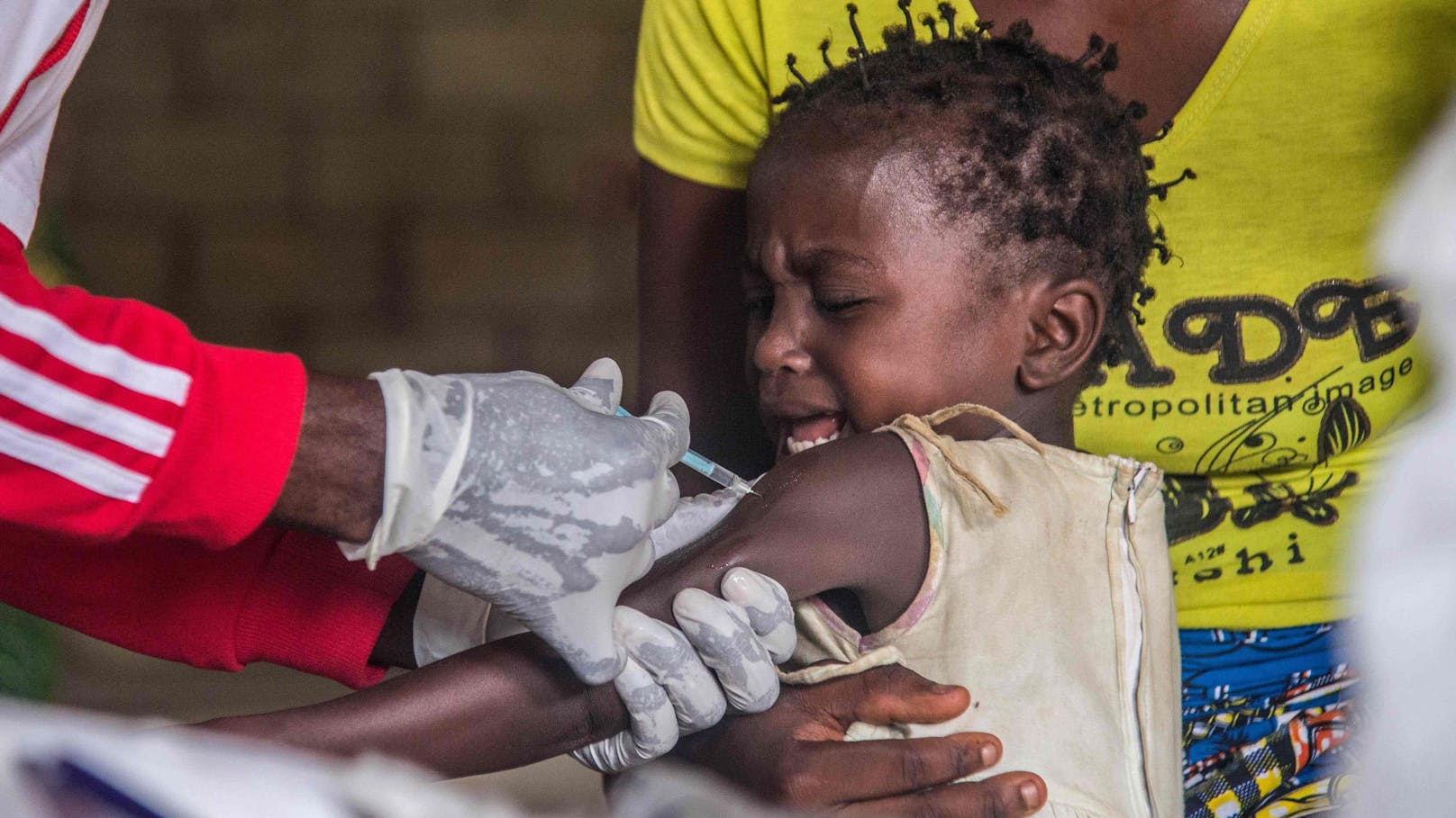 Masern-Impfung in Afrika (Archivbild)
