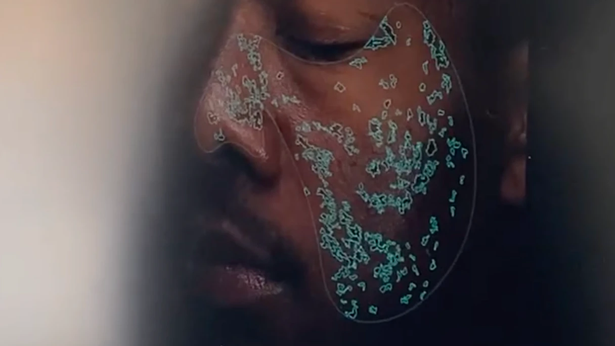 David Alaba bei der Hautanalyse.