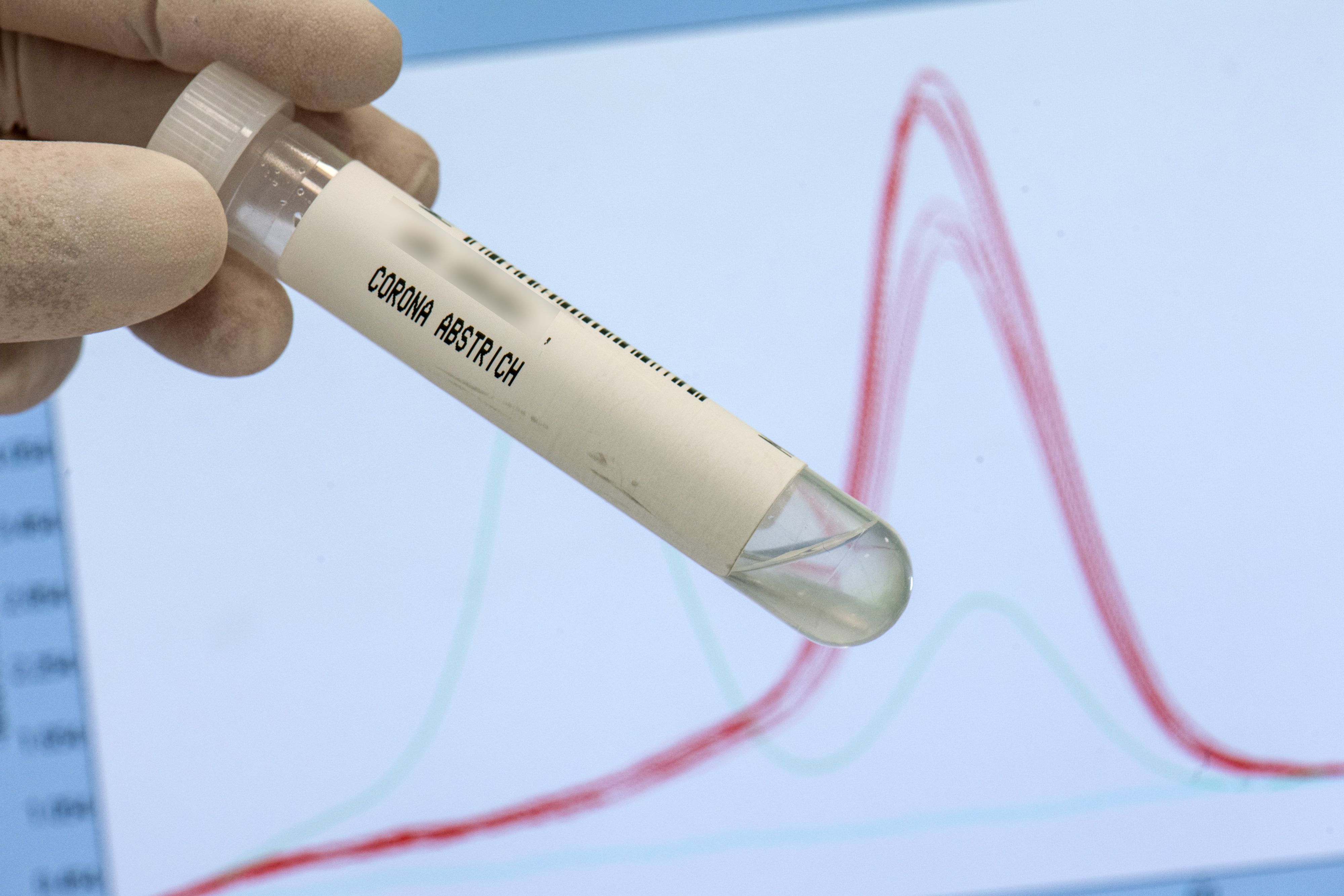 Bei der Maturareise in Barcelona haben sich zwei Linzer mit der Delta-Variante angesteckt.