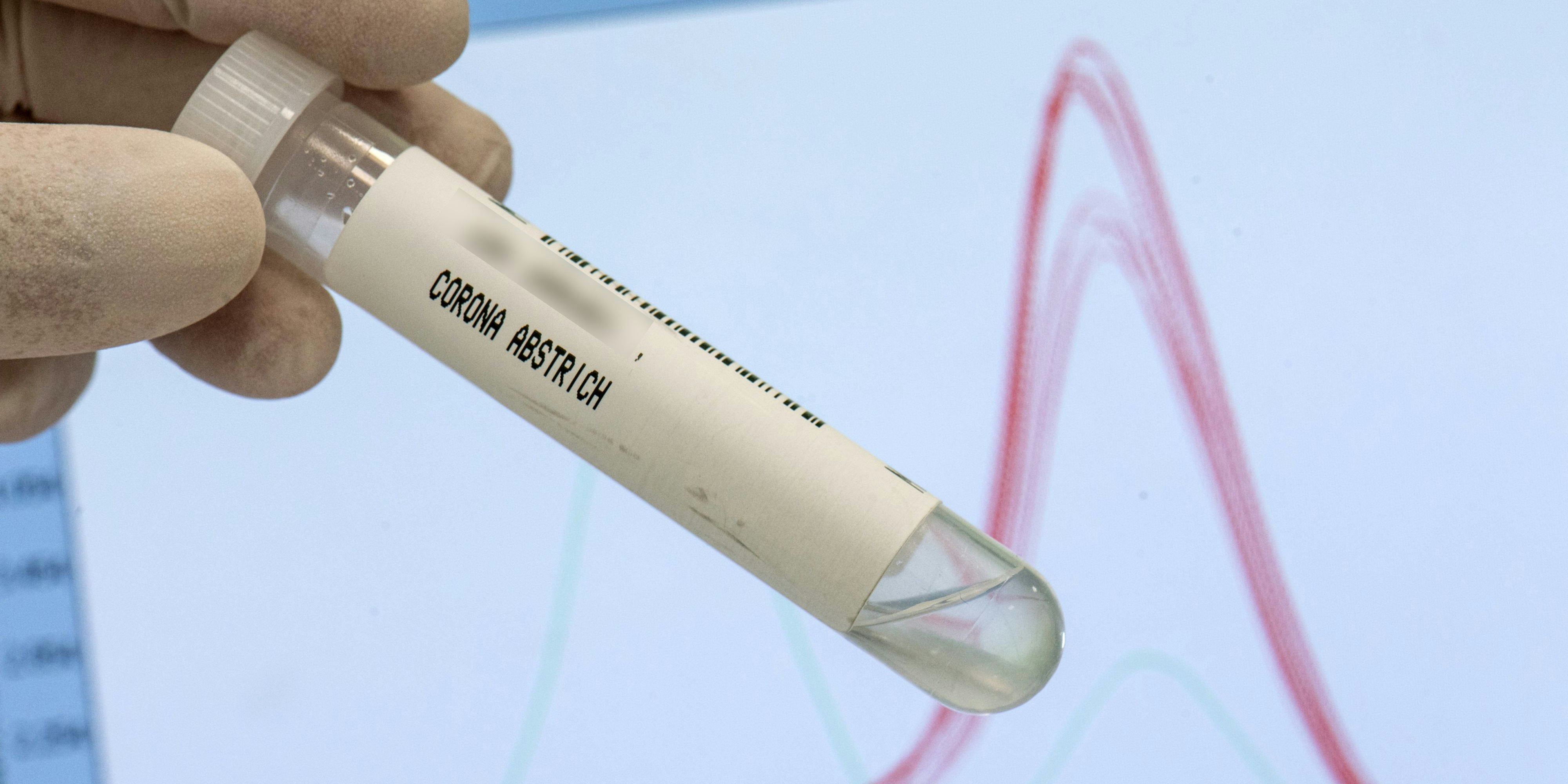 Bei der Maturareise in Barcelona haben sich zwei Linzer mit der Delta-Variante angesteckt.