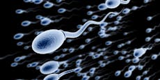 Spermienzahl bei Männern nimmt rasant ab