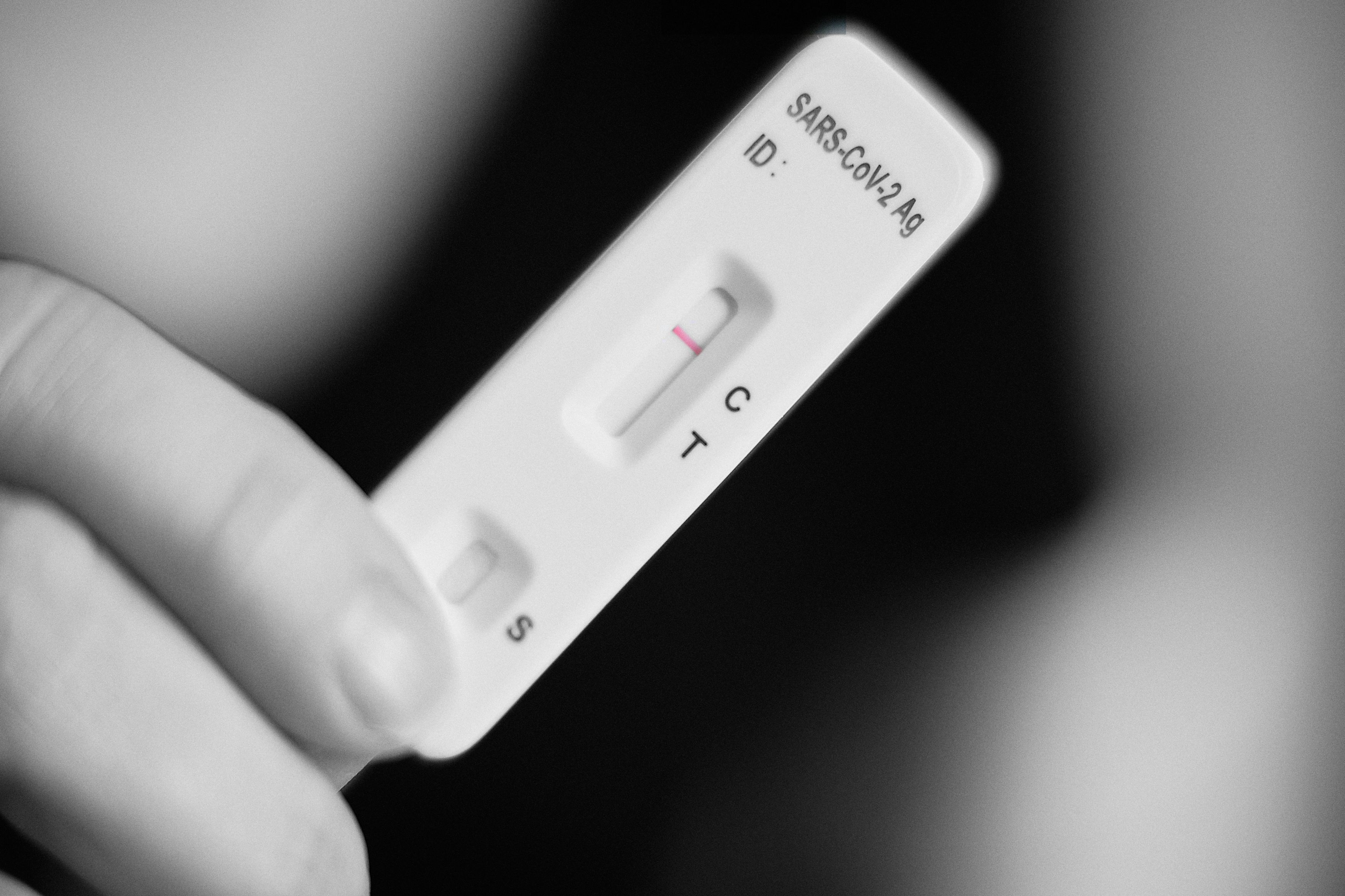 Antigen-Schnelltests könnten künftig wieder Verwendung finden, ihre Gültigkeit aber drastisch gekürzt werden.