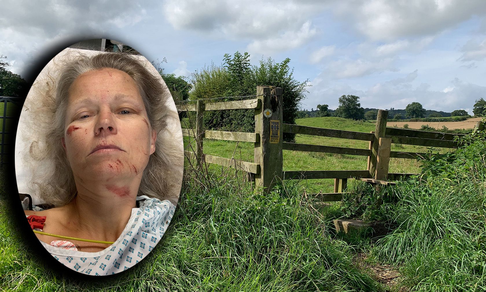 Ein völlig harmloser Hundespaziergang verwandelte sich für eine Britin in einen Alptraum