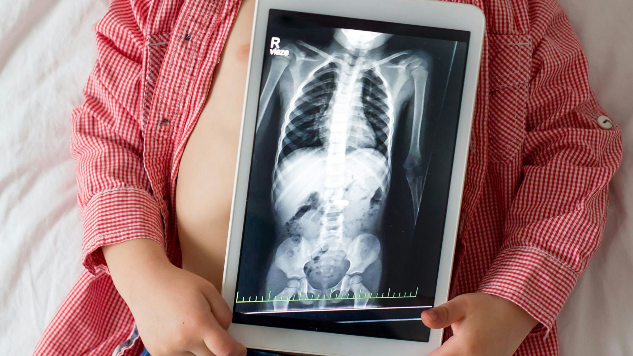 Toddler child, blond boy, holding x-ray picture on tablet of child body with swallowed magnet showing, child swallow dangerous object