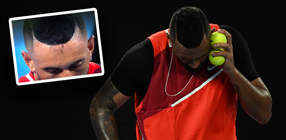 Nick Kyrgios kämpfte nicht nur mit Gegner Daniil medwedew, sondern auch mit der Haarfarbe. 