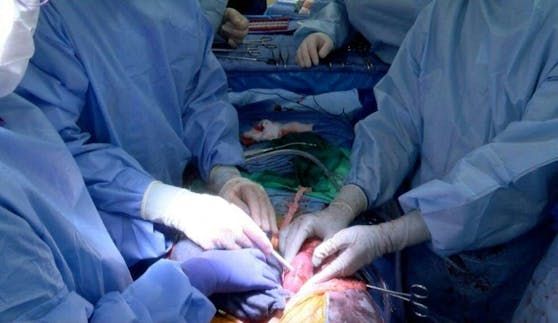 Wegen des Mangels an menschlichen Spenderorganen setzt die Forschung große Hoffnung in die Xenotransplantation.