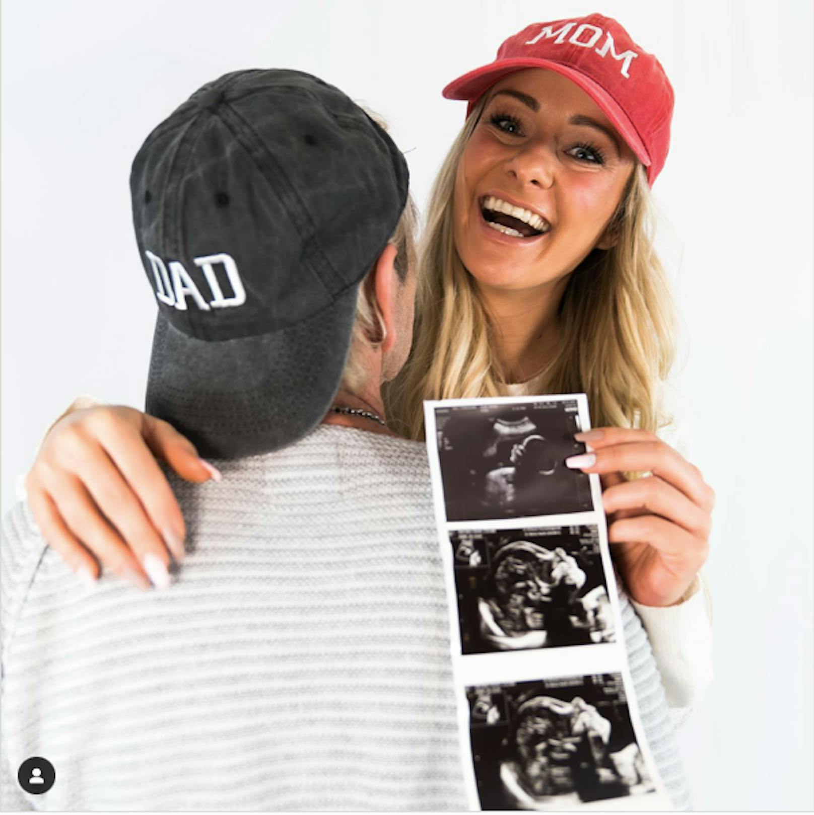 Matthias Reim und Christin Stark zeigen das erste Foto ihres ungeborenen Kindes