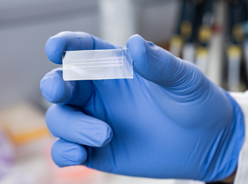Der neue Test soll anhand des Bluts von Patientinnen und Patienten unmittelbar anzeigen können, ob diese Antikörper gebildet haben oder nicht.