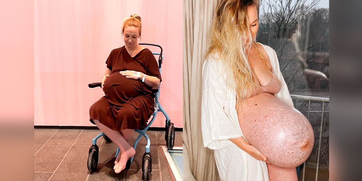 Schwanger mit Drillingen: Michella Meier-Morsi zeigte ihre gigantische Baby-Kugel