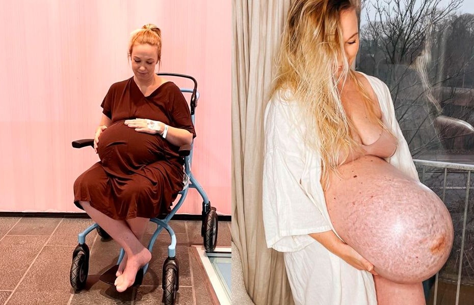 Schwanger mit Drillingen: Michella Meier-Morsi zeigte ihre gigantische Baby-Kugel