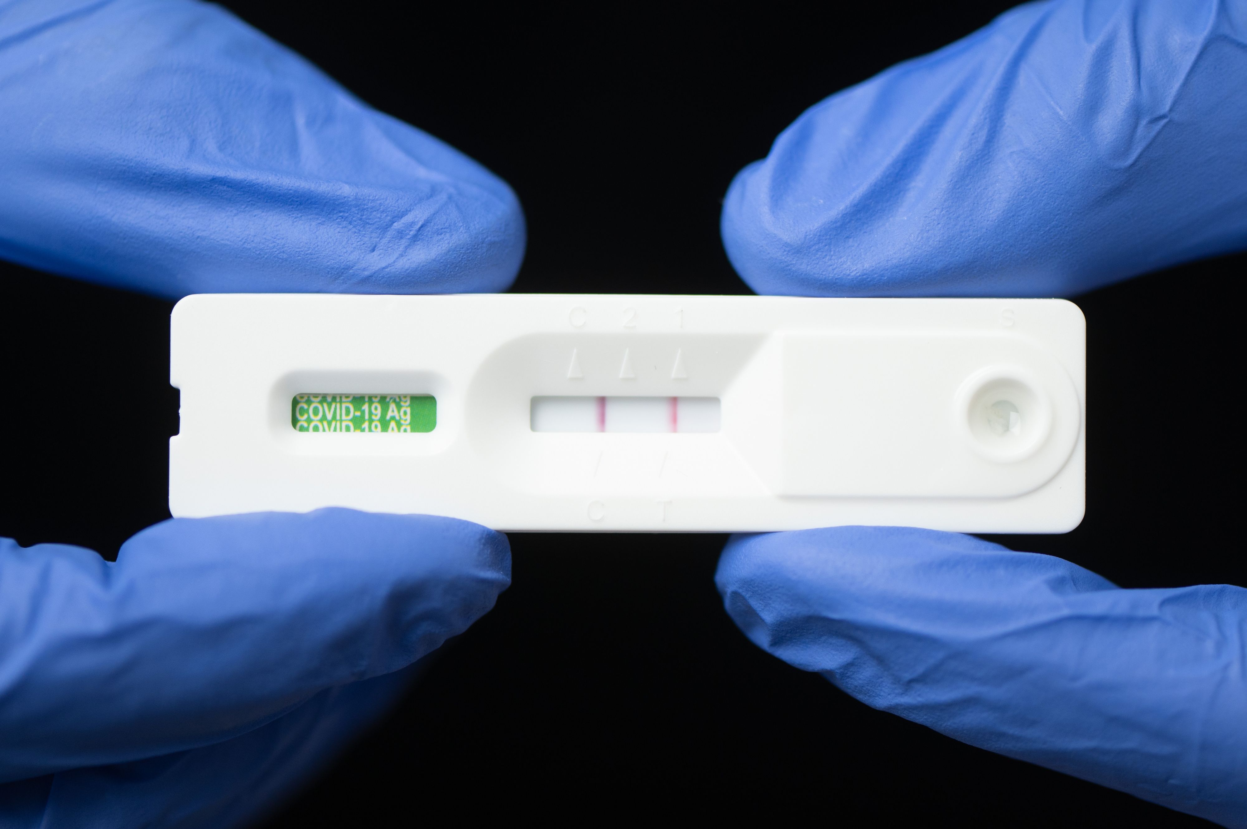 Auch eine überstandene Covid-Infektion erhöht das Sterberisiko. 