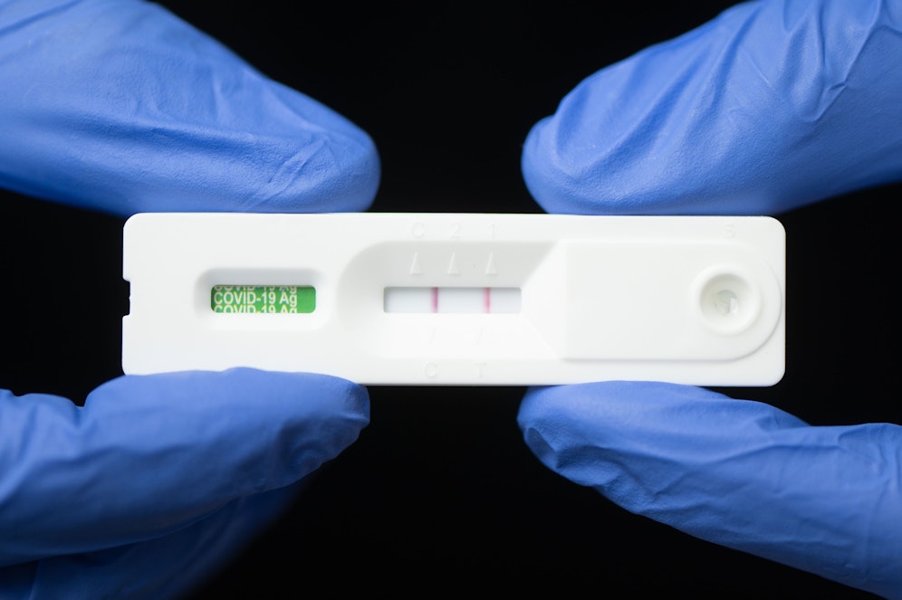 Auch eine überstandene Covid-Infektion erhöht das Sterberisiko. 