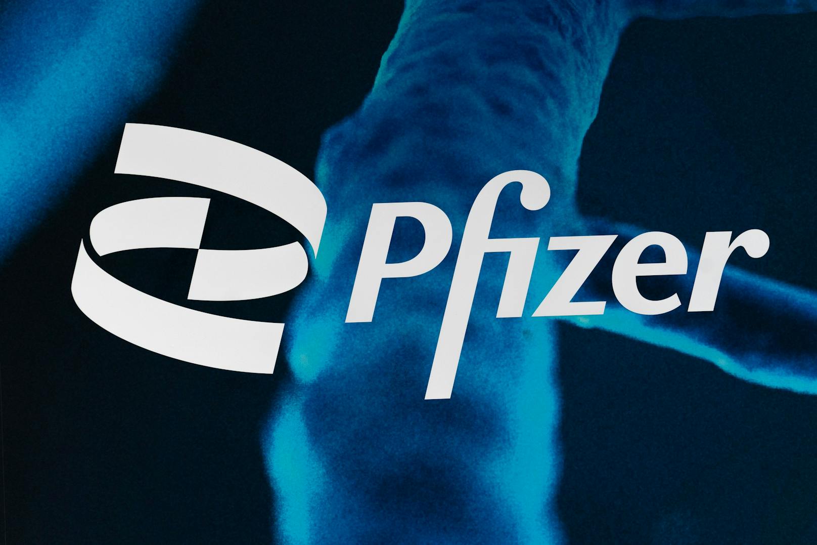 Neue Strategie: Pfizer-Pille im Kampf gegen Long Covid?